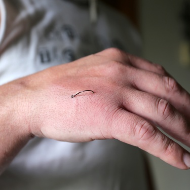 Help! What To Do if You Hook Yourself While Fishing