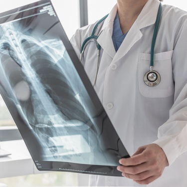 4 Tips for Choosing X-Ray Film Disposal Services